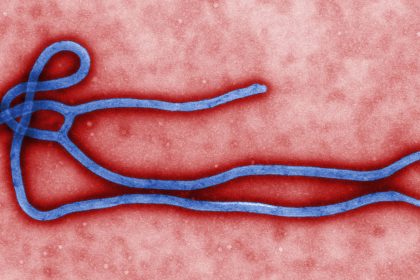 Ebola